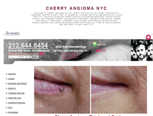 Tablet Screenshot of cherryangiomanyc.net